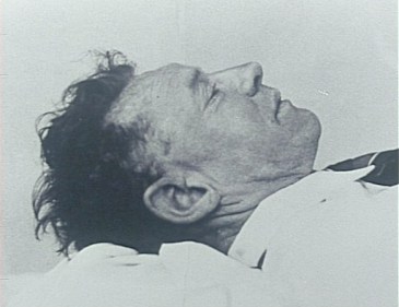 The unknown man found on Somerton Beach. Investigators have commented that the man's features, photographed sometime after death, give a misleading impression of his appearance in real life.