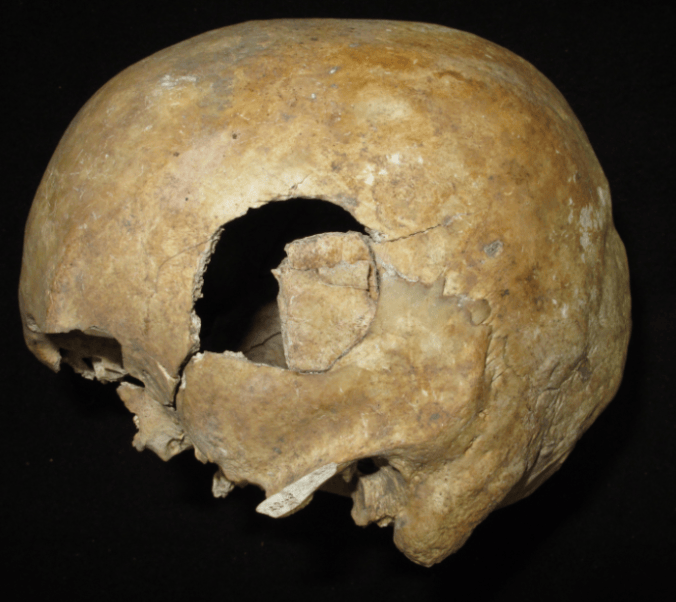 Towton battle damage.png