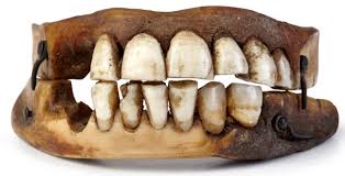 Human teeth implanted into C19th dental plate
