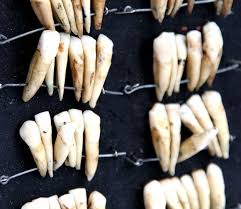sol;diers teeth
